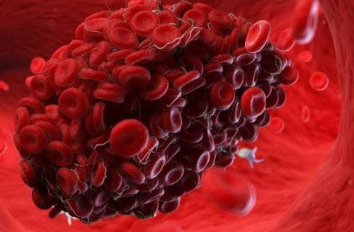 Fisiología plaquetaria, agregometría plaquetaria y su utilidad clínica