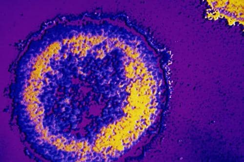 Aspectos inmunológicos en pacientes con VIH y terapia antirretroviral