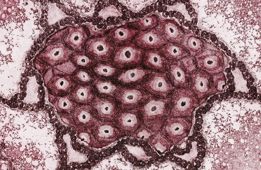 Frecuencia de las mutaciones más comunes del gen CFTR en pacientes peruanos con fibrosis quística mediante la técnica ARMS-PCR