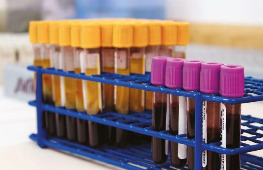 Estudio de inmunofenotipo por citometría de flujo para el diagnóstico de inmunodeficiencias primarias