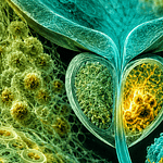 Biomarcadores tisulares en cáncer de próstata